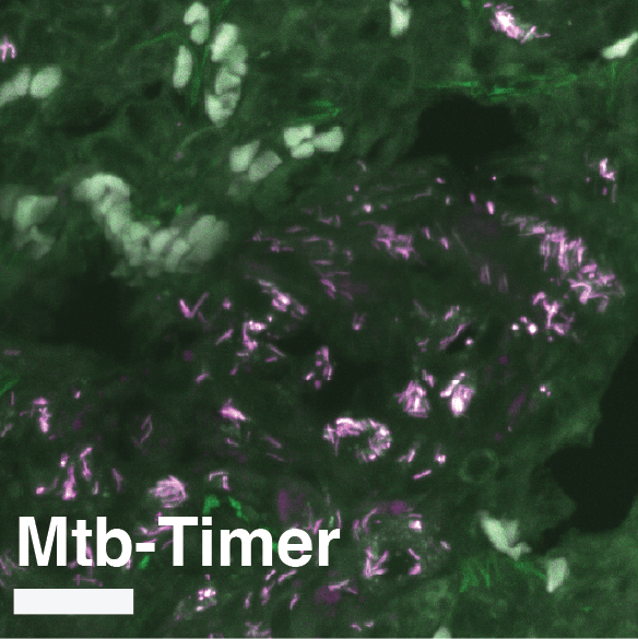 Supplementary Figure S8D Mtb-Timer